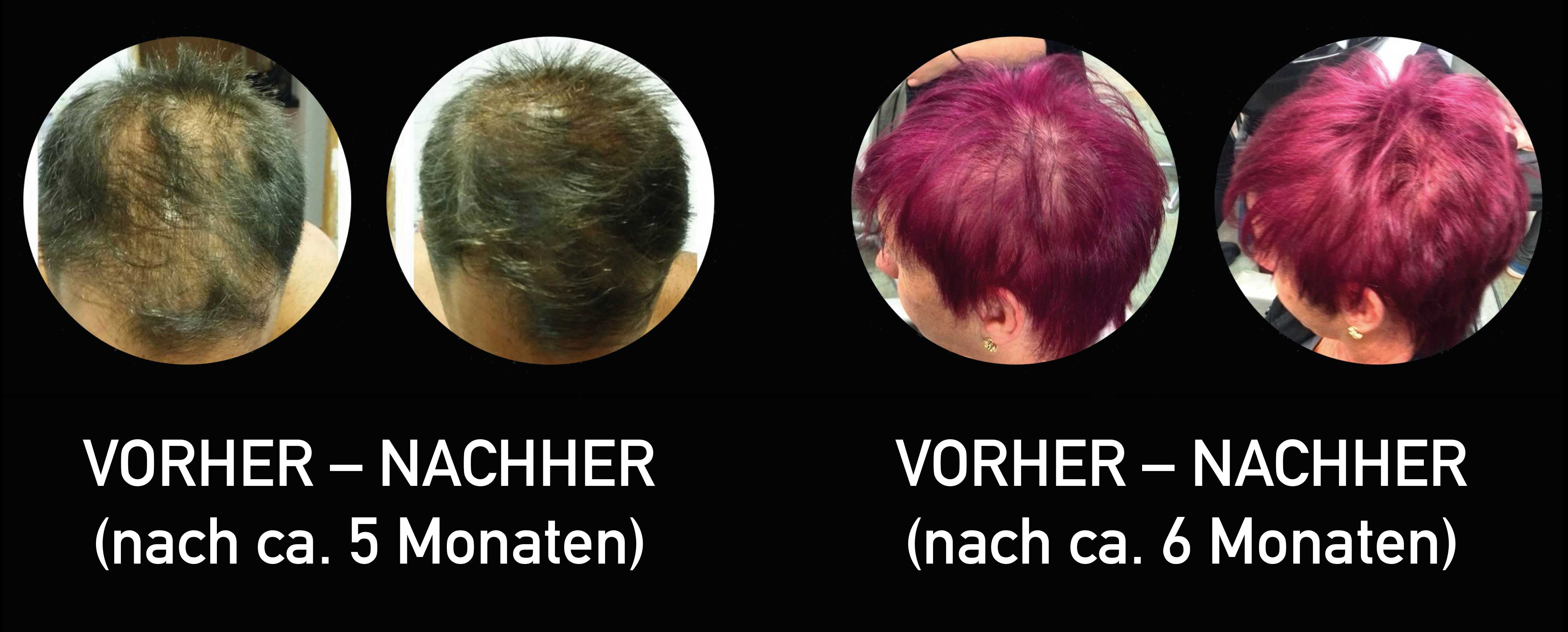 Kosmetikstudio Shannon, 1010 Wien - Gegen Haarausfall
